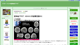 認知症の治療